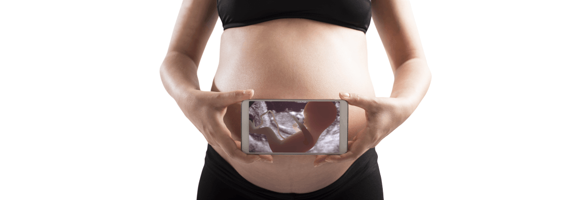 Butterfly Kisses Fetal Imaging Studio